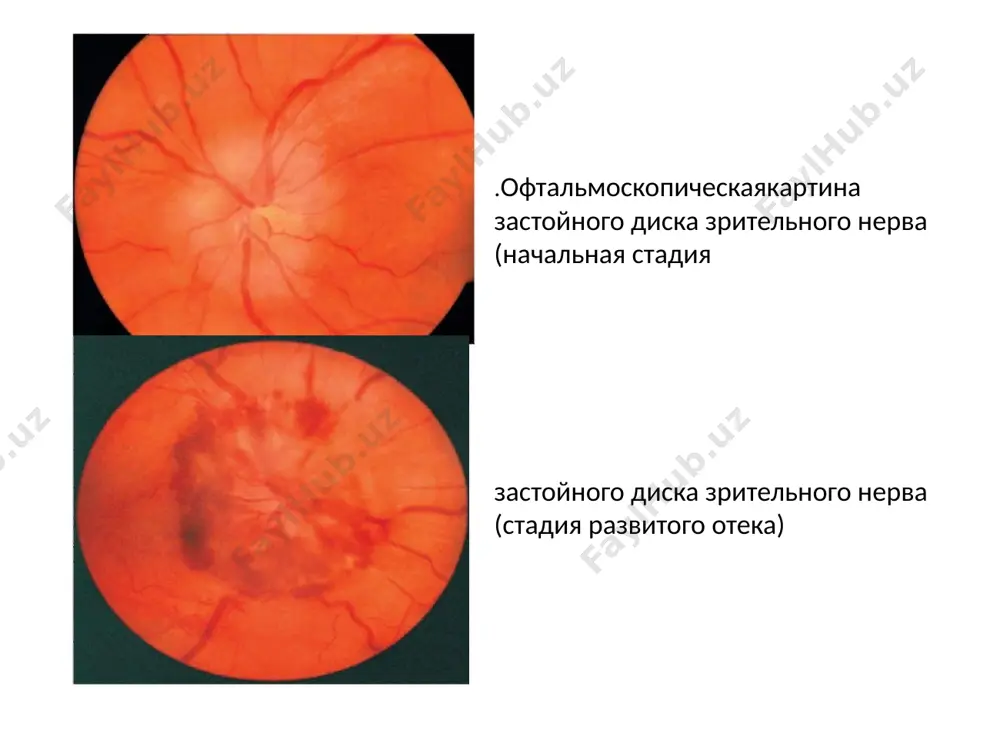 кулез, грипп, острый инфекционный менингит, менингоэнцефалит) предотвращает неврит. image1.jpeg image2.jpeg image3.jpeg image4.jpeg image5.jpeg image6.jpeg image7.jpeg image8.jpeg image9.jpeg image10.jpeg image11.jpeg image12.jpeg image13.jpeg image14.jpeg image15.jpeg image16.jpeg image17.jpeg image18.jpeg image19.jpeg image20.jpeg image21.jpeg image22.jpeg image23.jpeg image24.jpeg image25.jpeg image26.jpeg image27.jpeg image28.jpeg image29.jpeg image30.jpeg image31.jpeg image32.jpeg image33.jpeg image34.jpeg image35.jpeg image36.jpeg image37.jpeg image38.jpeg image39.jpeg image40.jpeg image41.jpeg image42.jpeg /docprops/thumbnail.jpeg