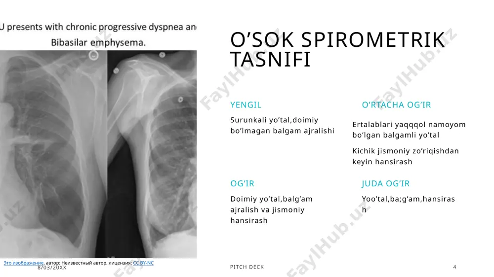 k 12 jarrohlik muolajalari (bullalarni olib tashlash, o’pka hajmini kamaytirish bo’yicha operatsiya va o’pka transplantatsiyasi) surunkali obstruktiv o’pka kasalligini davolashning so’nggi bosqichidir. endobronxial klapanni joylashtirish yoki termal ablyatsiya ma’lum bir guruh bemorlarning klinik jihatdan yaxshilanishiga olib kelishi mumkin. surunkali obstruktiv o’pka kasalligining terminal bosqichi bo’lgan bemorlarga palliativ yordam ko’rsatiladi. uning maqsadi hayot sifatini va kundalik ishlashni yaxshilashdir. 8/03/20xx pitch deck 13 surunkali obstruktiv o’pka kasalligi asoratlari havo oqimini cheklash va nafas olish yetishmovchiligidan tashqari, obstruktiv o’pka kasalligi quyidagi asoratlarni keltirib chiqarishi mumkin: o’pka emfizemasi; bronxoektaziya; nafas yetishmovchiligi; o’pka yurak; o’pka emboliyasi; yurak ritmining buzilishi: polimor bo’lmachalar taxikardiyasi, bo’lmachalar fibrilatsiyasi. surunkali obstruktiv o’pka kasalligini oldini olish xavf omillarini aniqlash va ularni yo’q qilish ushbu kasallikning oldini olishda eng muhim qadamdir. bunga quyidagilar kiradi: chekishni tashlash; ikkilamchi tutun ta’sirini yo’q qilish; havo ifloslanishi ta’sirini kamaytirish. image1.jpeg image2.jpg image3.jpg image4.jpg