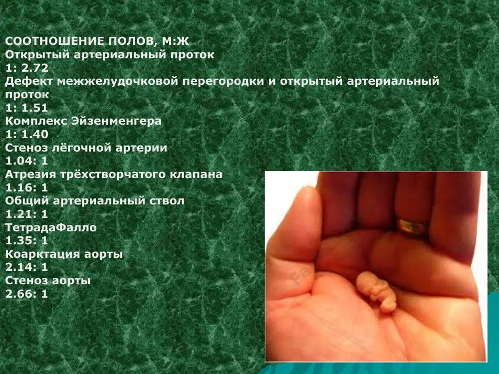 толы левого желудочка по происхождению выделяют: 1. первичный (идиопатический) 2. вторичные жалобы: 1. повышенная утомляемость 2. головные боли 3. головокружения 4. обмороки 5. боли в области сердца 6. ощущение перебоев в работе сердца при аускультации чаще выслушиваются изолированные щелчки или их сочетание с позднесистолическим шумом. они не проводятся за пределы сердца, нарастают в интенсивности в начале в вертикальном положении и при физической нагрузке перикардиты шум трения перикарда –признак фиброзного сухого перикардита возникает в различные фазы сердечной деятельности в отличие от внутрисердечных шумов место, продолжительность и сила меняется не связан с тонами. часто во 2-3 межреберье слева симптом герке экг изменения на экг –вызваны ишемическими изменениями в субэпикардиальной части миокарда в i-ii-iii стандарт. отв. avf, v 5-6 st приподнят на 1-3 мм в аvr, v 1-2 st ниже изолинии,t на изолинии. q отсутствует клиника инфекционный эндокардит симптоматика складывается из трех основных синдромов: 1) токсикоза 2) поражения эндокарда 3) тромбоэмболических осложнений диагностика …