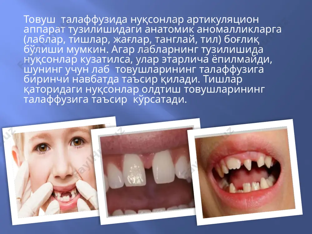 лаги, ликопча, арра, расм, бўри, малика ва бошқалар.) жарангли ва жарансиз ундошларни текширишда (п-б, т-д, к-г, ф-в, с-3) болаларда жарансизлантириш даражаси ҳар доим ҳам бир ҳил кечавермайди. такрорлаш учун сўзлар: бошоқ, вагон, кон, зайтун, маймун. махсус вазифалар ёрдамида артикулятсия ҳаракатларини ўзгартириш қобилияти текширилади. болага одатда товуш ёки бўғин сериясини бир неча бор такрорлаш таклиф этилади ва кейин товушлар ёки бўғинлар кетма-кетлиги ўзгаради. ўтувчанлик осон ёки мураккаблиги қайд этилади. а-и-у, у-и-а ва бошқалар; ка-па-та, па-та-ка, та-па-ка; пла-плу-пло, пло-плу-пла ва бошқалар кап-пак-кап-пак... рал-лар-рал-лар... бир нечта ундош товуш кетма-кет келган бўғинлар орқали ҳам текширилади: скла, взма, здра ва бошқалар. боланинг ҳар хил бўғинли сўзларни талаффуз қилиш қобилиятини ўрганиш учун унга турли предметли расмларни тақдим қилиб уларни номлаш сўралади, сўнгра ушбу сўзлар такрорлаш учун қўлланилади. иккала турдаги вазифаларнинг натижалари таққосланади ва бола қайси турдаги вазифани бажаришда қийналмаганлиги белгиланади. весипед –велосипед бўғинларнинг соддалаштирилиши: тулъ -стул, бўғинларни ўхшатиш: топток-копток, бўғинлар сонини қўпайтириш: весисипед -велосипед, бўғинлар сонинг …