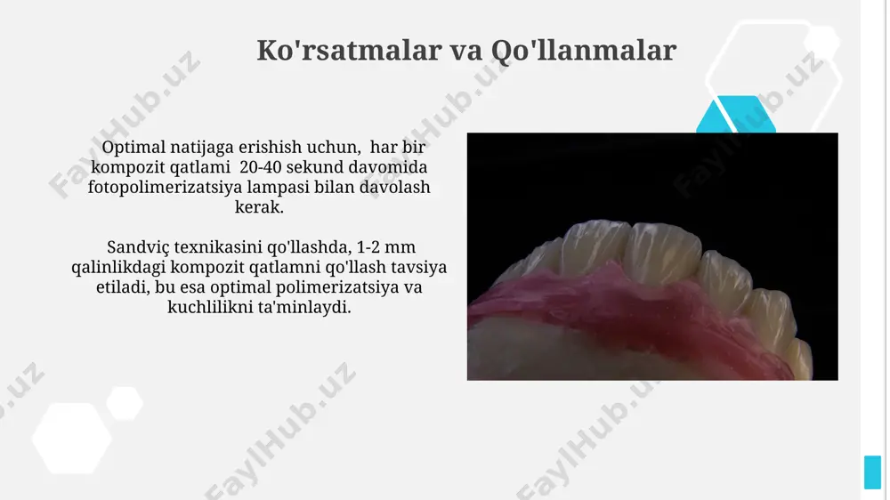 stomatologiyada sandvich usulida plombalash - Page 4