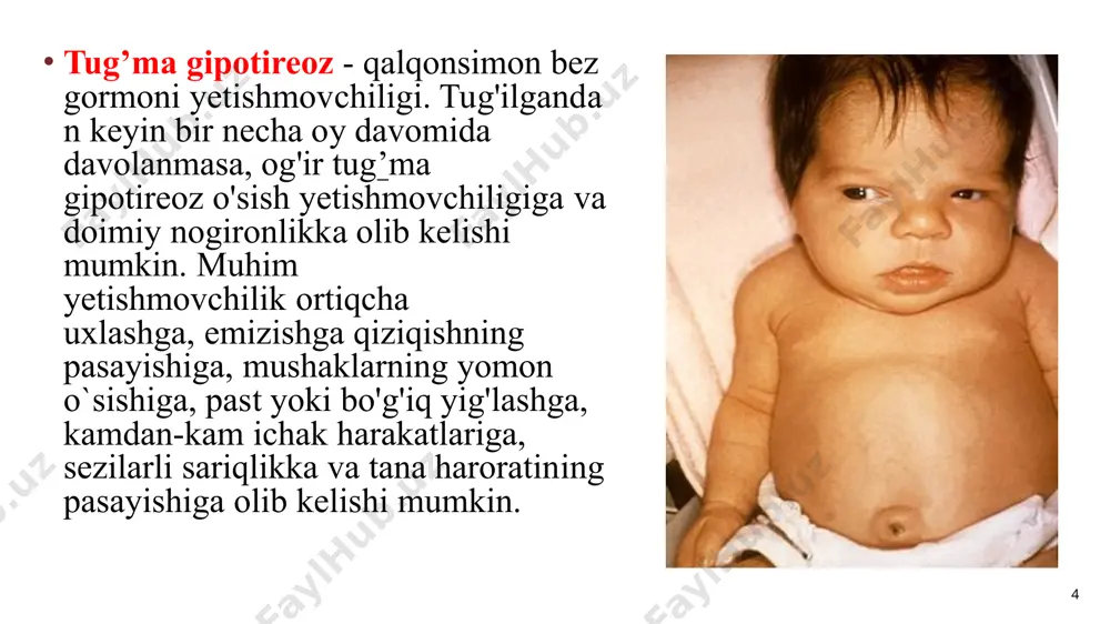 tug`ma gipotireoz - Page 4