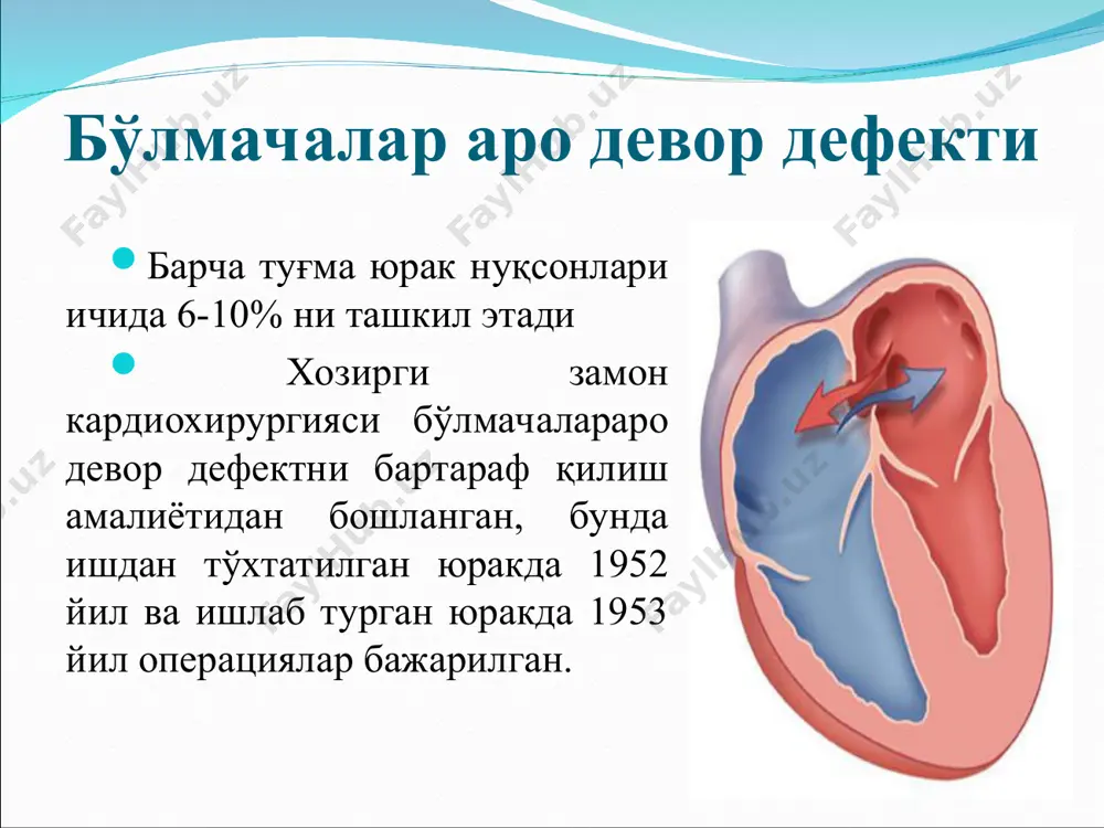 нчалар аро девор дефекти сохасига моқ тикилган юрак девори нуқсонини ёпиш учун транскатетр системали (амплатзер) окклюдер фалло тетрадаси ўпка артериясиини торайиши қоринчалар аро девор дефекти аорта ни ўнг томонга силжиши ва уни қоринчалар аро девор дефекти устида жойлашиши ўнг қоринча деворининг гипертрофияси фалло тетрадасида бармоқ фалангаларидаги ўзгаришлар блелок – таусиг бўйича ўмров ости – ўпка анастамози аорта коарктатцияси бош оғриши артериал кон босимининг ошиши буриндан қон кетиши юрак сохасидаги оғриқлар юрак уриши тезлашиши бошда оғирликни ва пулсацияни сезиш аорта коарктатцияси аортал қопқоқ нуқсонлари аорта клапанининг етишмовчилиги (аке) - яримойсимон клапанлар аорта оғзини тўлиқ ёпмаган ҳолда, диастола вақтида юрак чап қоринчасига қоннинг қайтиб кириши билан характерланади сабаблари: органик аке: ревматик эндокардит аортанинг сифилитик шикастланиши атеросклероз сепсис аорта оғзини кириш қисмдаги шикастланишлар функционал аке: клапан тавақаларининг ўзи зарарланмасдан, клапан оғзини кенгайиши кузатиладиган ҳолда, аортанинг қуйи қисми кенгайиши билан боғлиқ касалликлар ( аорта аневризмаси, гипертония касаллиги, сурункали нефрит) юрак туғма нуқсонлари аорта клапани …
