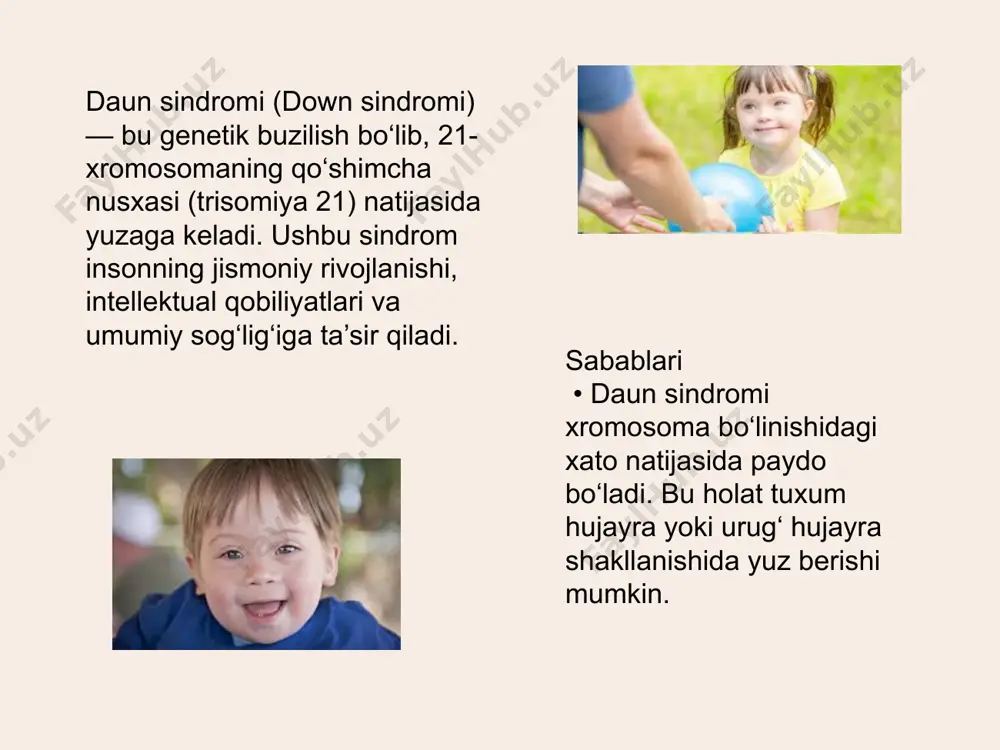 daun sindromi - Page 2