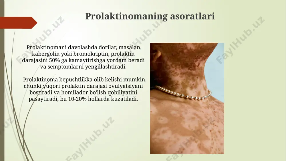prolaktinoma sindromi - Page 5