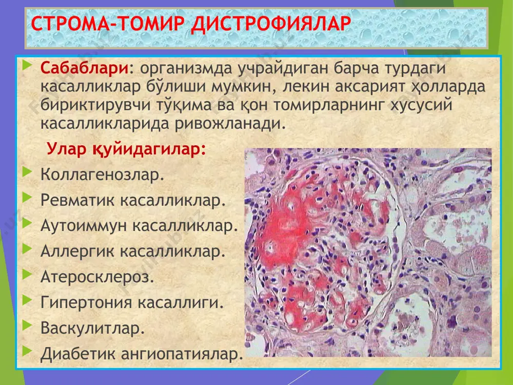 к касалликларда. морфологияси: макро – томир шишасимон найга айланади; микро – эндотелий остида гомоген, қизил модда тўпланган, томир бўшлиғи торайиб, ёпилган ҳолатда. сосудистый гиалиноз, накопление гиалина в субэндотелиальной зоне за счет повреждения эндотелия, базальной мембраны и мышечного слоя.. причины: гипертонич. болезнь, гипертензии, сахарный диабет. локализация: почка, головной мозг, сетчатка глаз, панкреас, кожа. виды: простой –гипертонич. болезнь; липогиалин – диабетич. микроангиопатия, сложный гиалин – иммунопатологические болезни. морфология: макро – артерия превращается в стекловидные трубочки; микро – в субэндотелиальной зоне гомогенное вещество –гиалин, просвет сужен или закрыт. бириктирувчи тўқима гиалинози, бу – чандиқ бириктирувчи тўқимада коллаген толалар фибриноид бўкиши ва деструкцияси, унга плазма оқсиллари ва полисахаридларнинг бирикиши, гиалин пайдо бўлиши. сабаблари: чандиқлар, склероз, келоид, суринкали яра, ўсмалар. макро: склерозга учраган тўқима қаттиқ, оқиш, ярим-ялтироқ кўринишда. микро: бириктирувчи тўқима толалари фибриллярлигини йўқотган, бир-бири билан қўшилишиб, қизил рангли гомоген гиалин моддасига айланган. гиалиноз соединительной ткани, это – фибриноидное набухание и деструкция коллагеновқх волокон в …