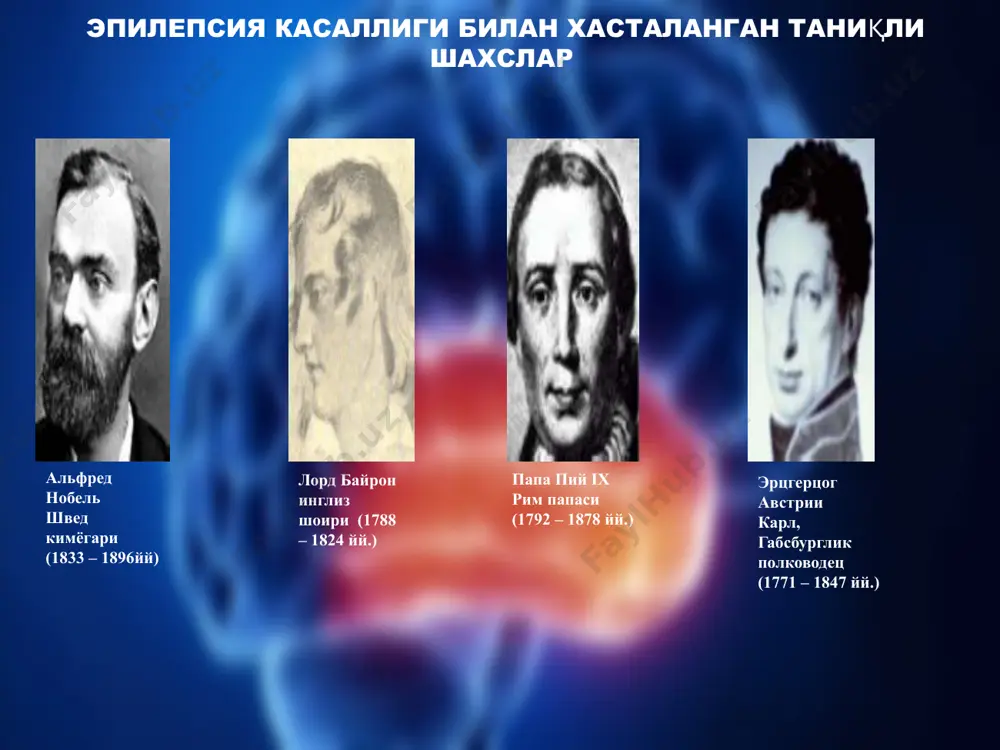 а мурракаб булишлари мумкин: 1. оддий абсанслар факат онг учиши билан кузатиладилар; 2. мурракаб абсанслар эса баъзи бир мушакларни титираши билан кузатиладилар. масалан кулнинг титираши, ковокнинг титираши ва хоказо. эпилептик статус (status epilepticus) : качонки талвасалар бир-биридан кейин кузатилса ва бемор узига келмаса бу холат эпилептик статус деб номланади. бу холат хаёт учун жуда хавфли хисобланади, чунки миянинг шишига олиб келиши мумкин ва шу натижади улимга. 3. тоник постурал талвасалар – ута кучли тоник фаза билан характерланади. бемор опистотонусга тушади. учог миянинг поя кисмида жойланади. эпилепсия билан хасталанган беморларда шахс ва характерни узгаришлари беморда тафаккури ёпишкок, беъмани, инертли булади. нутки монотон, тортишимли. хотира пасаяди ва специфик бузилади: бемор унга тегмайдиган нарсаларни дарров эсидан чикаради, лекин унга тегишли нарсани майда батафсил нарсаларгача эслайди. хиссий сферада хам узгаришлар хам ажойиб булишади: туйгуларнинг полярлиги кузатилади – сузлари ширин ва ёкимли булгани билан беморлар сержахл ва тажовузкор булишади, уларни бирорта-бир инсон хафа килса куп …