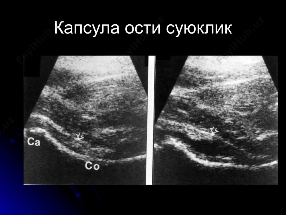 таянч-харакат тизими касалликларининг нур ташхиси - Page 5