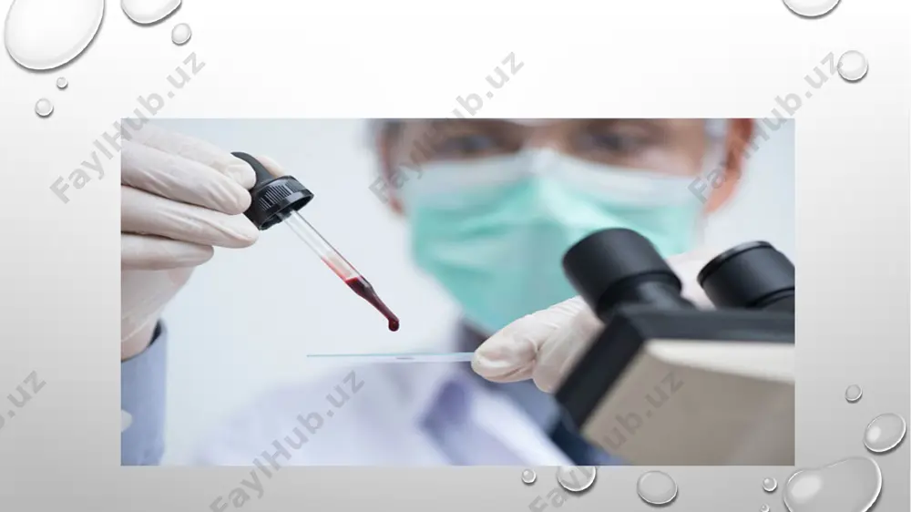 ulalari yuzasida (immunoglobulinlarga xos) aminokislotalar yoki uglevodlarning ma'lum komplekslari. quyilgan qon retsipient organizmiga quyidagicha ta'sir ko’rsatadi: o'rnini bosuvchi (qonning organizm tomonidan yo'qolgan qismini to’ldirish); gemodinamik (yuqtt ga keng qamrovli ta'sir); immunologik (granulotsitlar, limfotsitlar, sitokinlar va boshqalar tufayli); gemostatik (retsipientning gemostaz tizimiga qo’zg’atuvchi ta'sir); rag'batlantiruvchi (gipotalamus-gipofiz-adrenal tizimni rag'batlantirish, bazal metabolizmni kuchaytirish, fagotsitar faollikni oshirish va boshqalar) qon quyish usullari 1. vena ichiga yuborish (asosiy usul hisoblanadi) 2. intraarterial (katta qon ketishida) 3. suyak ichiga (hozirgi kunda ishlatilmaydi) komponentlar va qon mahsulotlari: qon (yangi sitratlangan va konservalangan donor qoni); qon komponentlari (eritrotsitlar, leykotsitlar va trombotsitlar massasi, plazma); qon preparatlari (kompleks ta'sir etuvchi - albumin, oqsil; qon ivish tizimining korrektorlari - kriopretsipitat, protrombin kompleksi, fibrinogen, trombin, gemostatik bulutcha, fibrinolizin; immunologik ta'sir etuvchi - immunoglobulinlar - antistafilokok, qoqshol, virusga qarshi) qon o’rnini bosuvchi moddalar: bular yo'qotilgan qonning o'rnini bosish yoki buzilgan qon funksiyalarini normallashtirish uchun mo'ljallangan dorivor eritmalardir. qon o'rnini bosuvchi moddalar; gemodinamik ta'sir …