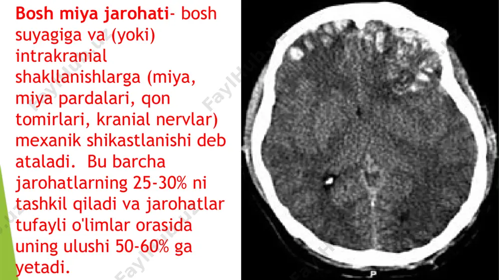 i so‘z va jumlalarni tushirib gapiradi. bunda bemorning gapirgan gaplarini tushunish qiyin bo‘lib qoladi. maniakal-depressiv psixozning depressiv bosqichida tafakkurning sekinlashuvi kuzatiladi. bunda bemorning tafakkuriga biror tushuncha chuqur o‘rnashib qoladi. bemor qisqa jumlalar bilan sekin-sekin cho‘zib gapiradi. test sinovlari 1.psixofiziologiya qanday fan? a)psixik va fiziologik jarayonlar oʻrtasidagi munosabatlarni oʻrganuvchi fan. b)hujayralarni oʻrganuvchi fan c) muloqot va munosabatni oʻrganuvchi fan d) falsafani oʻrganuvchi fan 2.psixofizagiyada tan olib kelmayotgan psixik jarayonlar ongning ichida tugʻiladi va uning ichida yakunlanadi degan gʻoya kim tomonidan inkor qilinadi ? a) i.m. sechenov b) a.s makarenka c) l.s vigots d) p.k anoxun 3.sechenov "miya reflekslari" asarini nechinchi yil nashr etgan ? a)1862 b)1863 c)1864 d)1865 4.nechinchi asrning 60-80yillarida psixofiziologiya jadal rivojlandi ? a) xxi b) xv c) xx d) xix 5.miya qanday parda bilan qoplangan ? a) nuqtali parda bilan b) oʻrgimchak uyasimon va tomirli c) zanjirli parda d) tugunlardan iborat parda 6.inson asab tizimining toʻqima tarkibiy qismi …