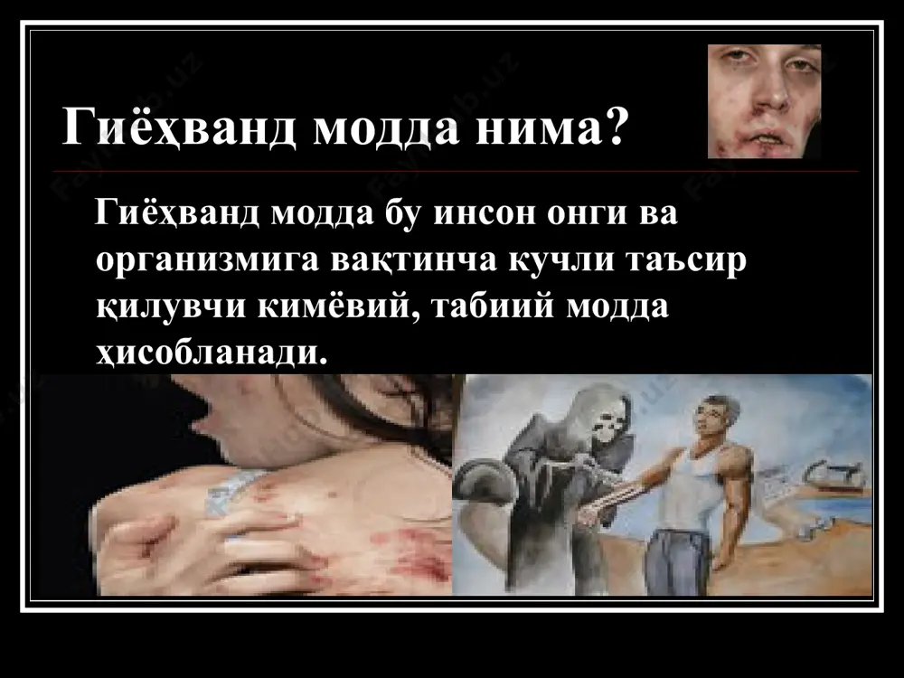 теъмол қилинмоқда. статистика маълумотларига кўра бугунги кунда дунёда 8 миллиондан ортиқ киши героин, 13 миллиондан ортиқ киши кокаин, 141 миллиондан зиёд киши марихуана (наша) ҳамда 180 миллиондан ортиқ киши сунъий наркотик моддалар истеъмол қилар экан. транзит наркотиков гиёҳванд моддалар гиёҳванд модда турлари кокаин опиумные поля опиумные поля наркотические поля звуковые наркотики наркотики в таблетках и капсулах гиёҳванд моддалар кухонные заготовки наркотики нацелены на «систему поощрения» мозга депрессия эйфория галлюцинация студенты и школьники наркоманы среди нас наркоманы наркоманы наркоманы наркоманы наркоманы виды приема наркотиков дети таксикоманы дети токсикоманы наркоманы последствие наркотиков последствие наркотиков последствие наркотиков последствие наркотиков дети наркоманов дети наркоманов дети наркоманов дети наркоманов дети наркоманов коаксил жертвы наркотиков коаксила жертвы наркотиков коаксила последствие наркотиков коаксила последствие наркотиков коаксила последствие наркотиков коаксила последствие наркотиков коаксила последствие наркотиков коаксила ампутация левого плеча крокодил наркотик крокодил – это другое, сленговое название наркотика дезоморфина. … наркоман, принимающий наркотик крокодил, буквально начинает гнить изнутри. …
