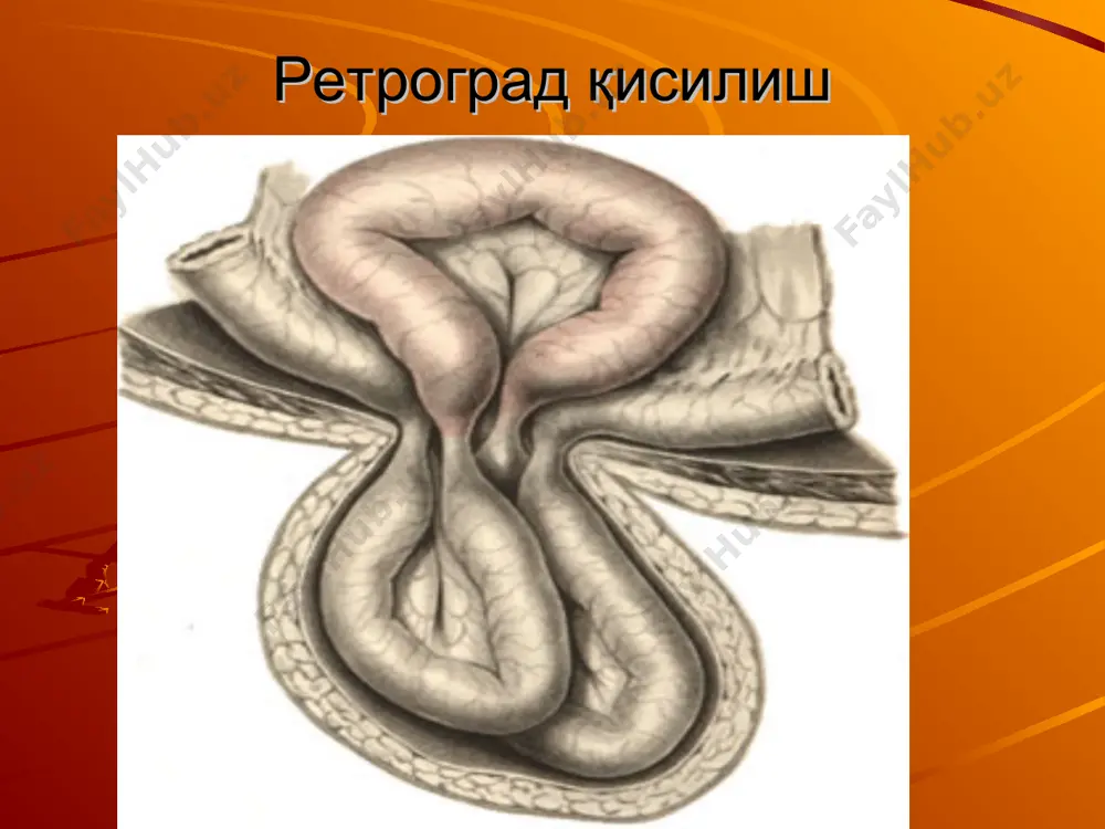 қорин чурраларининг асоратлари - Page 4