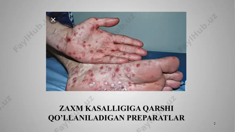 idi) ham foydalaniladi. ta'sir kuchi bo‘yicha ikkala preparat ham benzilpenitsillindan kuchsiz. treponemostatik samara ularning sulfgidril guruhi bor bo‘lgan fermentlar faolligini susaytirishlari natijasida yuzaga chiqadi. sil kasalligiga qarshi qo’llaniladigan preparatlar 6 7 silga qarshi vositalar farmakologiyaning keyingi 30 yil davomida erishgan yutuqla-ri natijasida ilgari davolash mumkin bo‘lmagan, asosan o‘lim bilan tugaydigan miliar sil, sil meningiti kabi kasalliklarni ham davolash imkoniyati paydo bo‘ldi. silni majmuaviy medika-mentoz davolashda asosiy o‘rinni ximioterapevtik vositalar egallaydi. bugungi kunda keng miqyosda ishlatilayotgan silga qar-shi vositalar olinish manbalari bo‘yicha 2 ta guruhga bo‘linadi: а. синтетик воситалар: б. антибиотиклар: изониазид рифампицин этамбутол стрептомицин сульфати натрий пара-аминосалицилати (паск) стрептомицин-хлоркальцийли комплекси бепаск циклосерин этионамид канамицин сульфати протионамид флоримицин сульфати пиразинамид тиоацетазон 8 silga qarshi vositalar sintetik vositalar antibiotiklar изониазид этамбутол натрий пара-аминосалицилати (паск) бепаск рифампицин стрептомицин сульфати стрептомицин-хлоркальцийли комплекси 9 silni zamonaviy davolash negizida har xil ta'sir mexa-nizmli ximioterapevtik vositalarni qo‘shib qo‘llash yotadi. sil-ga qarshi sintetik vositalarning ta'sir spektri juda tor …