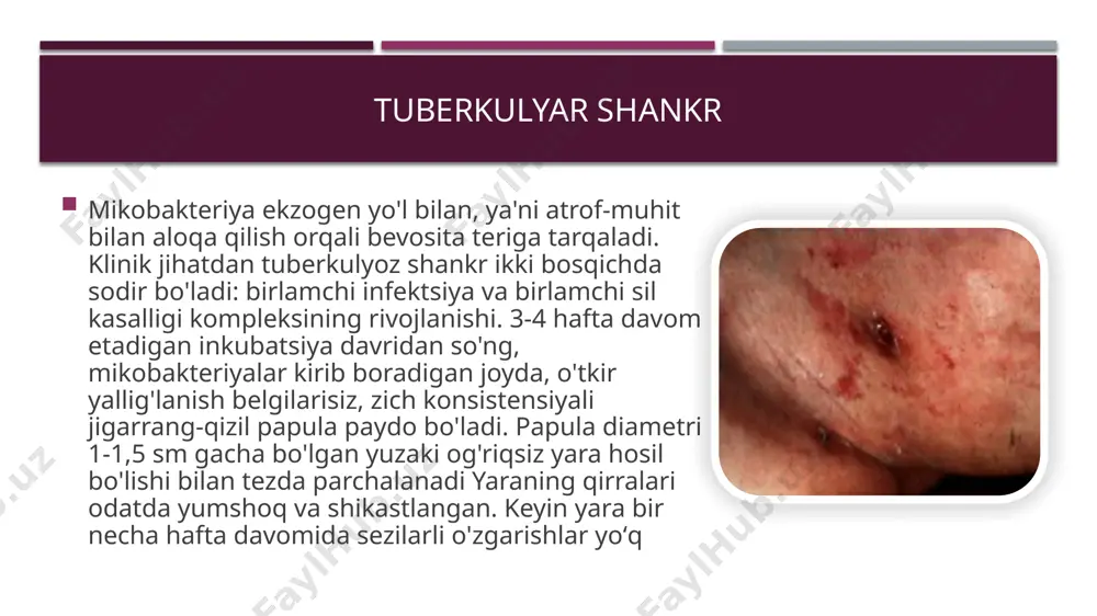 va osonlik bilan qon ketishi bilan rivojlanadi. yaraning pastki qismida va atrofida yangi sariq tuberkullar (trela ​​donalari) paydo bo'ladi. yaralar o'tkir og'riqli bo'lib, ularning joylashishiga qarab, ovqatlanish, defekatsiya va siydik chiqarishni qiyinlashtiradi. sil yugurigi yoki luipoid teri sili– teri silining boshqa xillariga nisbatan eng ko‘p uchraydigani bo‘lib (70-80%), aksariyat 5-15 yoshdagi bolalar orasida keng tarqalgan. ba’zan kasallik o‘rta yoshli yoki keksalar orasida ham uchrab turadi. teri sili o‘choqlari aksariyat (80%) bemorning yuzi, burni, yuqori lablari, lunji va quloq supralari sohasida joylashadi. ko‘pincha zararlangan o‘choqlarga terining shilliq qismi ham qo‘shilib ketadi. sil yugurugining birlamchi morfologik elementi do‘mboqcha yoki lyupomadir, u yarimsharsimon, chegarasi aniq, kattaligi igna uchiday va undan kattaroq, sarg‘ish-qizil rangli, yumshoq bo‘ladi, og‘rimaydi. yuzasi silliq yaltiroq kulrangda tovlanib turadi, keyinchalik xuddi shu joylar po‘st tashlaydi. po‘st tashlash, ayniqsa, yassi sil yugurugida ko‘zga yaqqol ko‘rinadi. do‘mboqchalar (lyupomalar) yuzasidan barmoqlar ohista yuritilsa, uning yumshoq konsistentsiyasi – sil yugurugining o‘ziga xos birinchi belgisi …