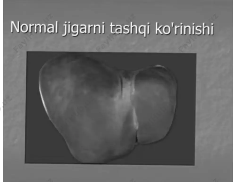 jigar va ot yo'llari kasalliklari - Page 3