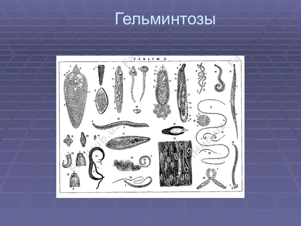которые дозревают в течение 4-6 часов активные движения остриц вызывают сильный зуд в окружности ануса. расчёсывая прианальную область , дети загрязняют яйцами пальцы и при несоблюдении правил личной гигиены заносят их в рот. факторы передачи нательное, пастельное бельё игрушки горшки другие предметы обихода продолжительность жизни остриц 3-4 недели, однако постоянные реинвазии обуславливают длительность заболеваний. клиническая картина : беспокоит зуд плохо спит становится раздражительным беспокойный боли в животе снижение аппетита ночное недержание мочи -у девочек может быть вульвовагинит - ссадины, дерматит отличаются упорным течении. длительная инвазия приводит : - к ослаблению памяти плохая успеваемость в школе диагностика соскоб с перианальных складок. трихоцефалез возбудителем является власоглавы , паразитирующие в основном в слепой кишке. тонким головным концом они внедряются в слизистую кишечника и питаются кровью. яйца власоглава выделяются с фекалиями и созревают в почве в течение 30-40 дней . заражение происходит при проглатывании зрелых яиц , из которых в кишечнике образуются личинки ,развивающиеся …