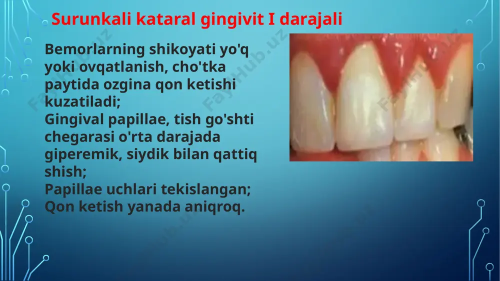 kataral gingivit - Page 4