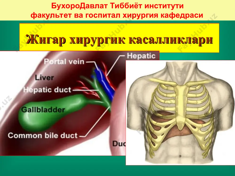 лари ??? лапароскопия лапароцентез изловчи катетер махсус диагностика усуллари * жигар жароҳатларида жигар тўқимасига чок қўйиш усуллари жигар чети жароҳатига чок қўйиш жигар жароҳатига чок қўйиш тахокомб гемостатик муолажаси амалиётдан кейинги асоратлар қорин бўшлиғига қон кетиши, ўт суюқлигини қорин бўшлиғига оқиши ва ўтли перитонит ривожланиши, механик сариқлик, холиемия, жигар етишмовчилиги, қорин бўшлиғи абсцесслари, сепсис, носпецифик асоратлар. жигар эхинококки жигар эхинококки жигар эхинококки узи кт кт кт кт жигар эхинококкози хитин пардаси дочерьние пузыри тухумлари махсус мослама - сўрғичлар лапароскопик операциялар учун асбоб-ускуналар эндоскопик мослама асбоблар * минилапаротомия мослама лапароскопик эхинококкэктомия нижняя поверхность печени верхняя и нижняя поверхность верхняя