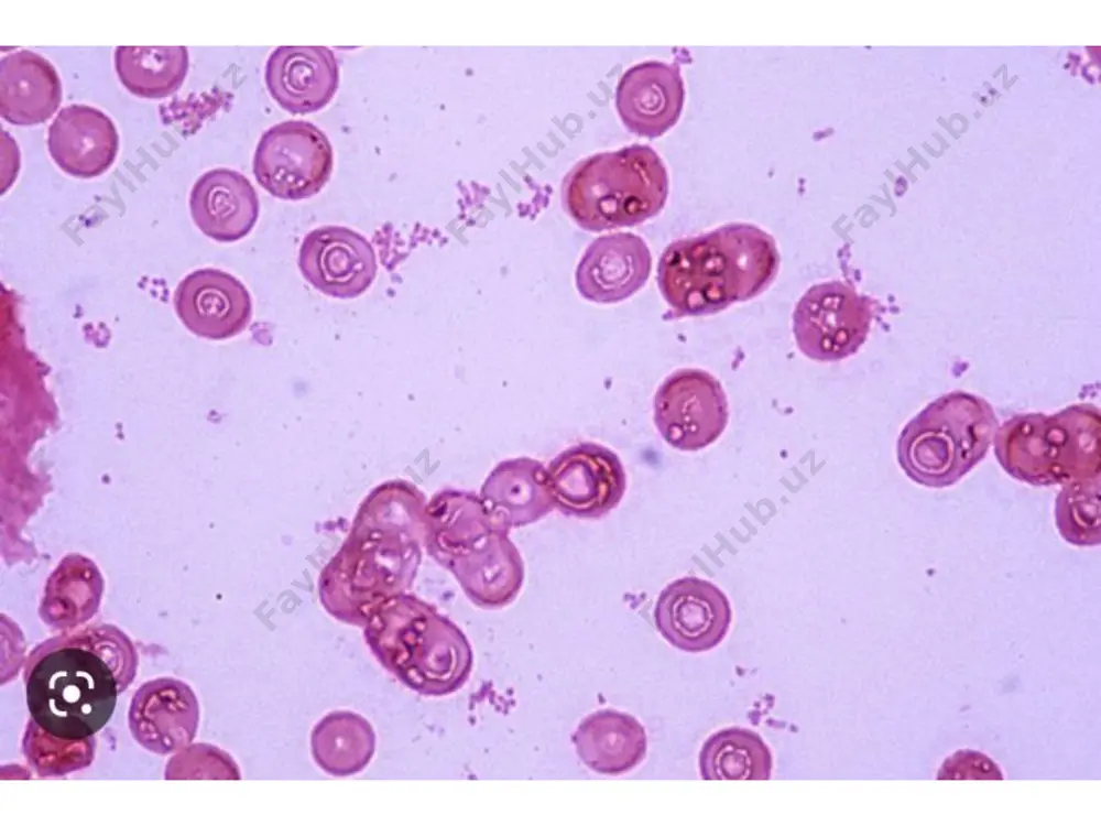 haemophilus influenzae vaktsinalari - Page 5