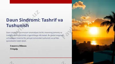 daun sindromi: tashrif va tushunish — PPTX