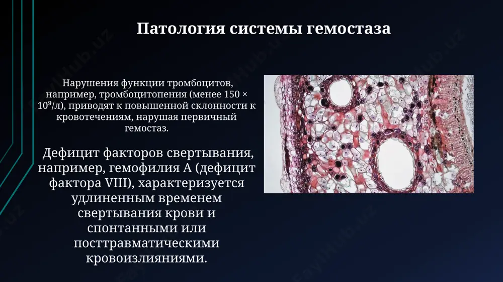 механизмы гемостаза и его патология - Page 5