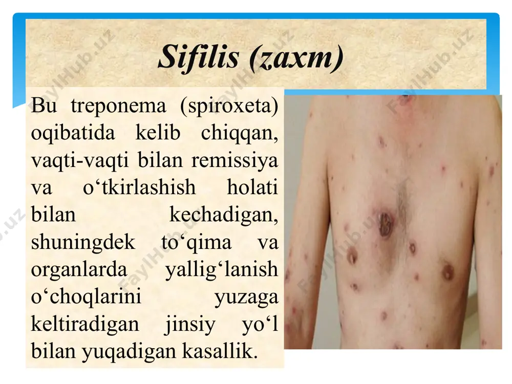 da 37 darajadan yuqori bo‘lishi; tungi vaqtda ko‘p terlash; doimiy charchoq; nafas qisishi; bezlar kattalashuvi; tezda vazn yo‘qotilishi; og‘iz bo‘shlig‘ida va tilda oq dog‘lar. ma’lumotlariga ko‘ra, kasallik bilan zararlangan har 8 insondan 1 si o‘zining oiv bilan zararlangani bilmaydi. oiv virusining tashxisi umumiy qon tahlili orqali aniqlanadi. agar oiv topilsa, musbat natija bo‘ladi. bu analiz takror qilib ko‘riladi. agar inson virus bilan zararlanish holatiga uchragan bo‘lsa, tezroq analiz tahlili topshirishi kerak. qanchalik erta qo‘yilgan tashxis, shunchalik davolashning unumini oshiradi. virus bilan zararlangandan so‘ng 3 oydan 6 oygacha test o‘tkazish kerak. oitsni aniqlash (diagnostikasi) hozirgi kunda oiv va oits ga qarshi maxsus dori vositasi mavjud emas. ayni mavjud bo‘lgan davolash usullari bilan insonlarni oiv virusi bilan uzoqroq muddat yashashini ta’minlash mumkin oitsni davolash antiretrovirus preparatlari proteaza ingibitorlari integraza ingibitorlari qayta transkriptaza ingibitorlari komoretseptor xemokin antogonsitlari e’tiboriz uchun rahmat! image2.jpeg image3.jpeg image10.jpeg image11.png image12.jpeg image13.jpeg image14.jpeg image15.jpeg image16.jpeg image17.jpeg image18.jpeg image19.jpeg image20.png …