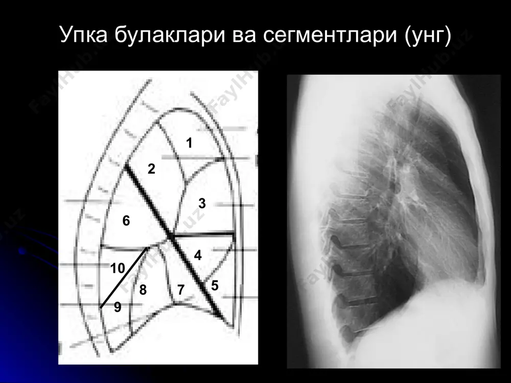 упка касалликларининг нур ташхиси - Page 5