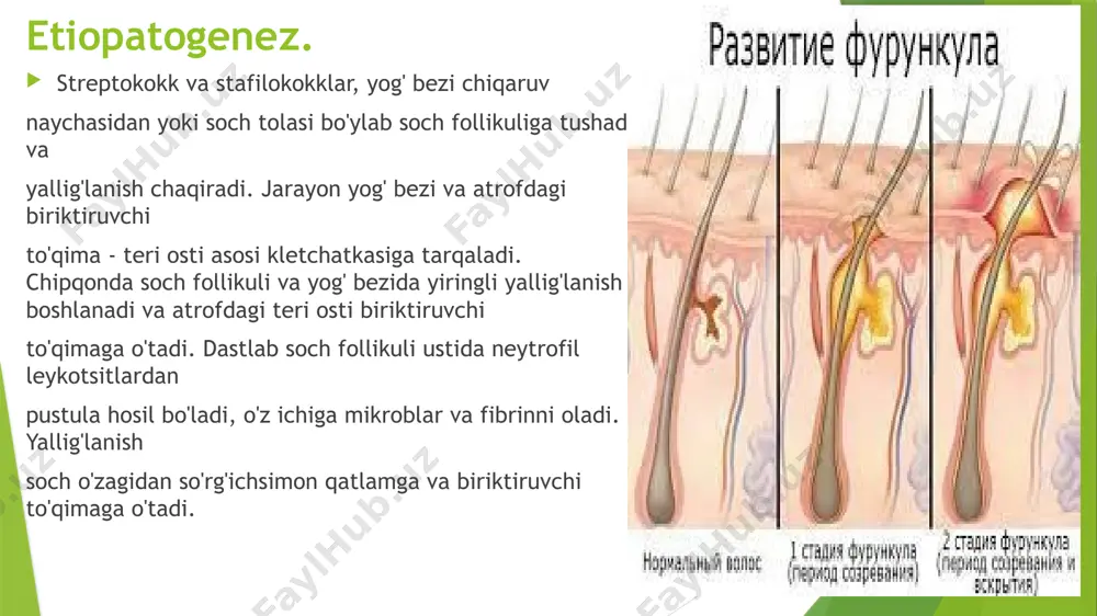 ida bo'lgan hollarda qattiq-quruq ovqat bilan cheklaniladi, ko'p gaplashish man etiladi.asosiy usul: jarrohlik yo’li asoratlari; tromboflebit va limfangit, tromboz, sepsis, yiringli meningitni limfadenitlar limfadenit — bu limfa tugunlarining spetsifik yoki nospetsifik yallig’lanishi o’tkir: seroz va yiringli surunkali: giperplastik va surunkali limfadenit o’tkirlashuvi etiologiya: patogen (piogen) mikroflora — streptokokklar va stafilokokklar va ular ishlab chiqaradigan toksinlar o’choqdan limfogen yo’l yoki qon oqimi bilan migratsiya qiladi. shuningdek infektsion agentlar limfa tomirlariga jarohatlangan teri yoki shilliq qavatlar orqali kirishi mumkin (kontaktli yo’li). o’tkir limfadenit klinikasi: boshni harakatlantirganda noqulaylik, kattalashgan limfatik tugunlar, paypaslaganda og’riq va zich elastik konsistensiya; jarayon yiringlashga o’tganda: tugun sohasida infiltrat,tugunlar bir-biri bilan qo’shilib tugun hosil qilib yiringlaydi, tana harorati 37,2-37,8 c xolsizlik, injiqlik, ishtaha buzilishi 21 o’tkir limfadenit klinikasi: bemor og’riq sindromi kuchayishini qo’zg’atmaslik uchun tananing muayyan qismlarida harakatni cheklashga majbur bo’ladi. yiringli erishda flyuktuatsiya kabi belgi paydo bo’ladi (yallig’lanish hududi palpatsiyasida suyuqlikning siljishi). adenoflegmona shakllanishli yiringli kapsulaning yorilishi alohida …