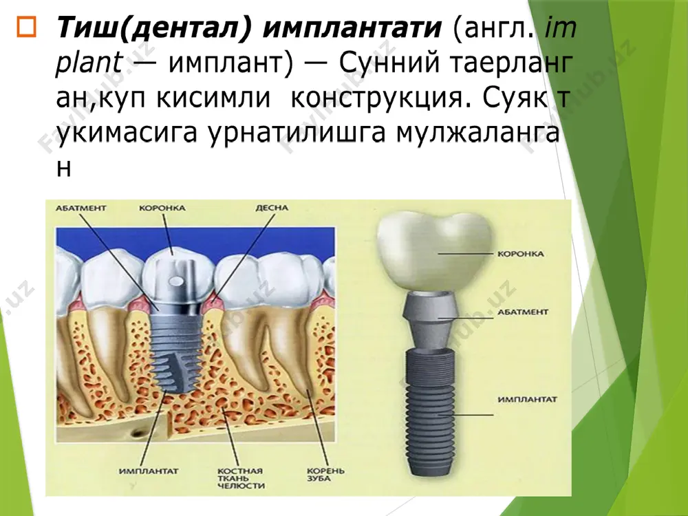 suyak ichi implantlari - Page 5