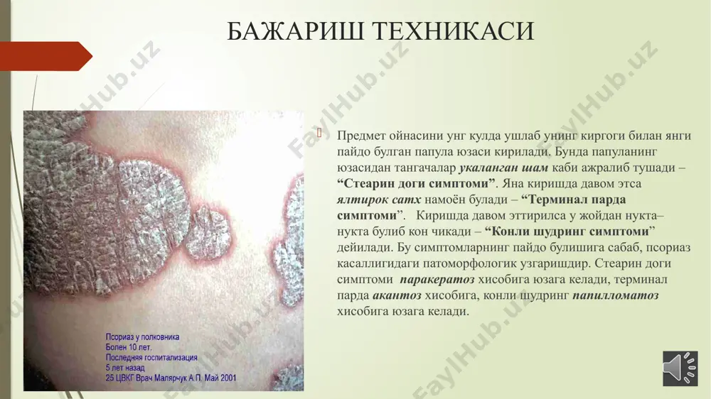 psoriarisga xos uchlik simptomni aniklash - Page 3