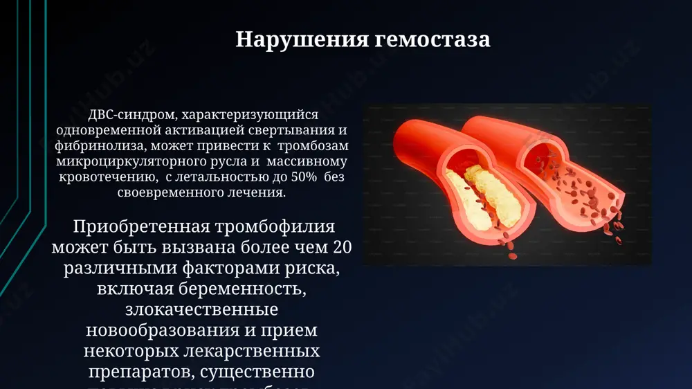 механизмы гемостаза и его патология - Page 3