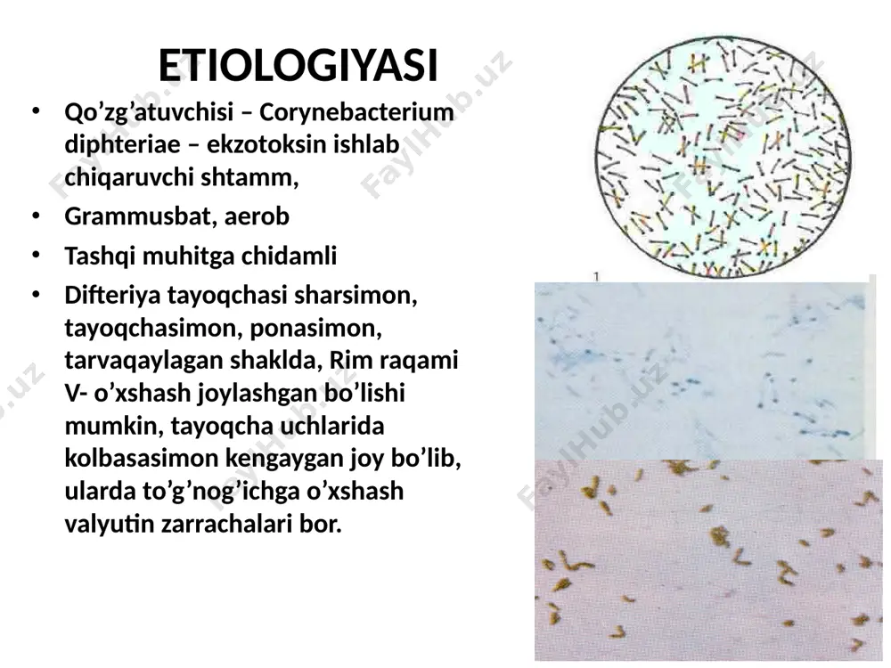 hakli difteriyaning bu shaklida gemorragik sindrom kuzatiladi. bunda difteriya pardasiga qon shimilgan bo’lib, terisi ostiga qon quyiladi, burnidan, tomog’idan, milkidan, oshqozon va ichakdan qon ketadi. oqibatb yaxshi bo’lmasligi mumkin. agarda bodom bezi va undagi difteriya pardasiga qon shimilgan bo’lib, terisida petexial toshmalargina bo’lsa, ammo qon ketish bo’lmasa, bemorni o’z vaqtida davolansa sog’ayishi mumkin. hiqildoq difteriyasi (chin bo’g’ma) kasallik prrogressiv holda kechadi va 3 davriga bo’linadi: kataral davri (1-2 kun davom etadi): isitma odatda o’rtacha darajada bo’ladi tovush dag’allashadi yo’tal bo’g’iq 2. stenotik davri (1-2 kun): yuqori nafas yo’llarining stenoziga xos belgilar kuchaya boshlaydi shovqinli nafas olish nafas olganda ko’krak qafasini bo’sh joylari ichiga tortilib, yordamchi mushaklar ishtirokida nafas olinadi 3. asfiksiya davri: gaz almashuvini buzilishiga xos o’zgarishlar kuzatiladi sianoz paradoksal puls terlash mushaklar tonusini pasayishi qorachiq kengayadi in’eksiyani sezmaydi, xushsiz gipotoniya, tomir urishi ipsimon vaqti-vaqti bilan tirishadi xoxishsiz ravishda peshob va najas ajraladi asfiksiyadan o’ladi chin bo’g’ma burun difteriyasi bemorni …