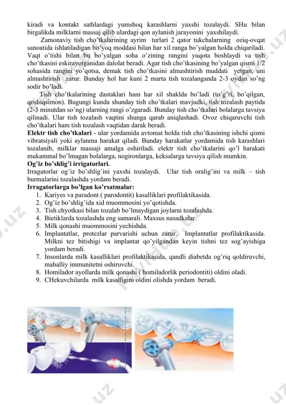 va juda qattiq tukli tish cho’tkalarini faqat parodont to’qimasi sog’lom bo’lgan kishilargagina tavsiya etiladi. shunda ham bordiyu tish cho’tkasidan noto’g’ri foydalanilsa, milklar shikastlanishi va tishlarning siyqalanish hollari vujudga kelishi mumkin. yumshoq va o’rtacha qattiqlikdagi tish cho’tkalari tukchalarining egiluvchanligi hisobiga tishlar oraligi, fissuralarga va milk osti sohalariga yaxshi kirib borishi natijasida yaxshi tozalash hususiyatiga ega bo’ladi tish cho’tkasining ishchi qismi o’lchamlari tishlarni qay darajada tozalay olish samarasini belgilaydi. qiyin tozalanuvchi sohalarga ham yetib borib, tishlarning barcha sathini tozalaydi. bugungi kunda (bolalar va kattalar uchun) kichik o’lchamli bosh qismiga ega bo’lgan tish cho’tkalaridan foydalanish tavsiya etiladi. bunday tish cho’tkalarni og’iz bo’shlig’ida har tomonlama harakatlantirish qulaydir. tish cho’tkalarining o’lchamlari bolalar uchun 18-25 mm, katta yoshdagi kishilar uchun – 30 mmgacha bo’lishi kerak. bunday cho’tkalarda ishchi qismining tuklari 3-4 qator bo’lib, tutam-tutam bo’lib joylashgan. zamonaviy tish cho’tkalarining ko’pchiligi ishchi qismidagi tukchalarning har xil o’lchamliligi bilan farq qiladi. bunda uzun tukchalar ishchi qismning periferik – …