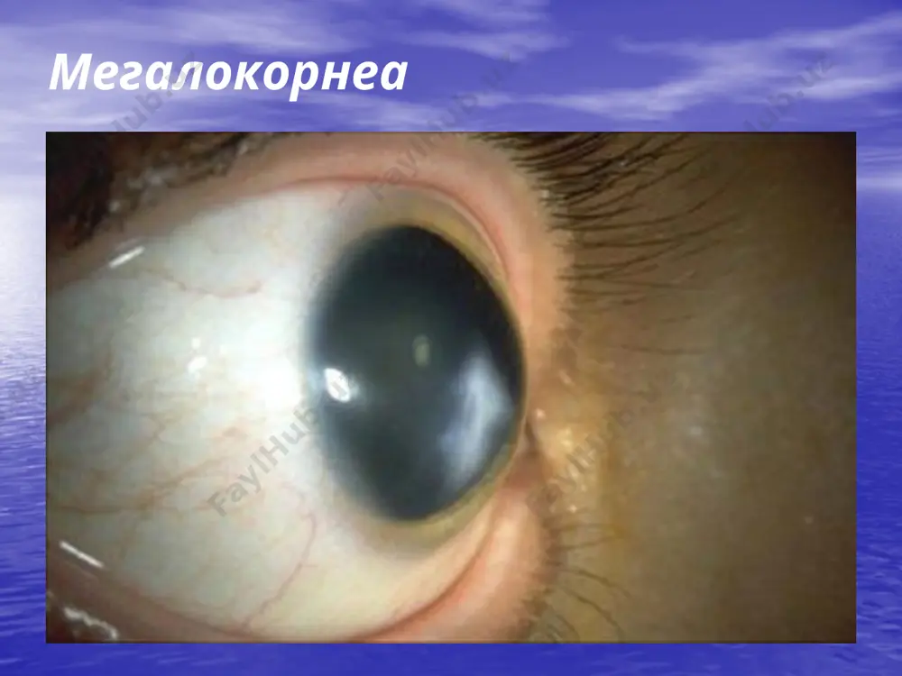 кератитлар - Page 5