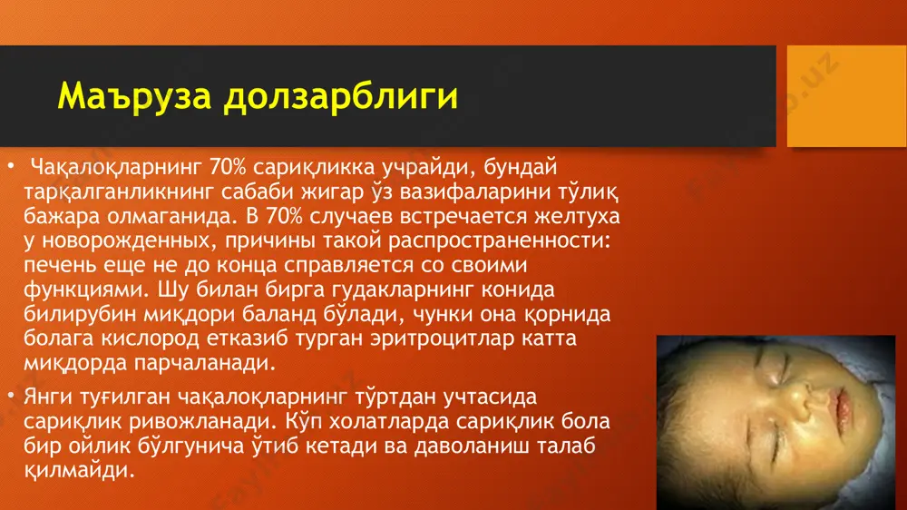 ферменти етишмовчилиги) - тугма глюкоза 6-фосфатдегидрогеназа (г-6-фд) ферменти етишмовчилигидан келиб чиккан сариқлик экспресс-саволнома ситуацион вазифа: чақалоқда 2-даражали сариқлик кузатилмоқда. савол: 1. терининг қайси майдонлари сарғайган бўлиши мумкин? 2. бу холатда билирубин миқдори қандай бўлиши мумкин? физиологик сариқлик – транзитор сариқлик тулиқ муддатда туғилган чақалоқларнинг 86,5% кузатилади. транзитор гипербилирубинемия чақалоқларда эритроцитларнинг тезлашган гемолизи, глюкоуронилтрансфераза ферментининг вақтинчалик ғўрлигидан келиб чиқади. боланинг умумий ахволи бузилмайди. теридаги сарик1лик 2-3 кунда пайдо бўлади ва 10-14 кунда йўқолади. қизил қон хужайралари сони, жигар ва талоқ хажмлари норма меъёрида бўлади. даволаниш: 5% глюкоза ёки 0,9% натрий хлориди эритмаси, фототерапия. коньюгацион сариқлик чала туғилган болаларда даволаниши узоқ давом этиб (4-6 ой), аниқроқ тасвирга эга бўлади. клиник жихатдан сариқлик аста-секин ўсиб боради, гепатомегалия ва спленомегалия кузатилмайди, нажас ва сийдик сарғаймайди, анемия кузатилмайди. сариқлик жигарнинг энзим факторлариннг вақтинчалик ғўрлиги сабабидан билирубиннинг конъюгацияси ва экскретициясида асосланади. янги туғилган чақалоқларнинг гемолитик касаллиги ушбу касалликнинг асосида она ва хомиланинг қони ва эритроцитар антигенлар …
