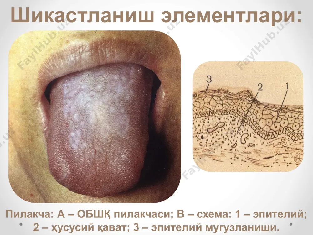 shikastlanishning morfologik elementlarini klinik namoyon bo‘lishi - Page 5