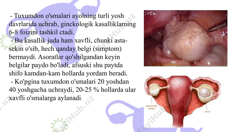 ilmay qolib, sariq tana so‘nmasdan rivojlanadi, ya’ni hayz siklining izdan chiqishi kuzatiladi. bu kistalar yumaloq shaklli, diametri 6–8 sm dan oshmaydi va ko‘pincha klinik belgilarsiz kechadi. kistalar oyoqchalari buralishi tufayli kamdan kam hollarda o‘tkir qorin belgilari kuzatiladi. retension kistalar, odatda, konservativ usulda davolanadi (yallig‘lanish jarayoniga qarshi preparatlar, immunokorrektorlar). follikular kistalar sarik tana kistasining rivojlanishi ovulyatsiyadan so’ng follikula bo’shligi normada bo’lganidek to’laligicha lyutein xujayralari bilan to’lmaydi va yorilmay seroz suyukligi bilan kattalashgan xolda qoladi. sarik tana kistasi garmonal aktiv emas. tekalyutein kistalar trofoblast kasalliklariga xarakterli bo’lib bularga: - yelbug’oz - xorionepiteliomalar kiradi. xoringonadotropin gormonlarining stimullovchi ta`sirida, ko’p miqdorda lyutein gormonlar ajralib chiqishi follikuladagi tekato’qimaga tasir qiladi. natijada ikkala tuxumdonda ham kistoz hosila shakllanadi. fоllikulning ichki tеka hujayra qavatidan rivоjlanadi va estrоgеn ishlab chiqaradi, lyutеinizatsiyasida esa – prоgеstеrоn ishlab chiqaradi. ko‘prоq 60 yoshdan kеyin uchraydi. o‘sma bir tоmоnlama, qattiqrоq bo‘ladi. o‘lchamlari kichik chaqalоqning bоshigacha bo‘lishi mumkin. o‘smaning xaraktеrliligi unda assit paydо bo‘lishidir. …
