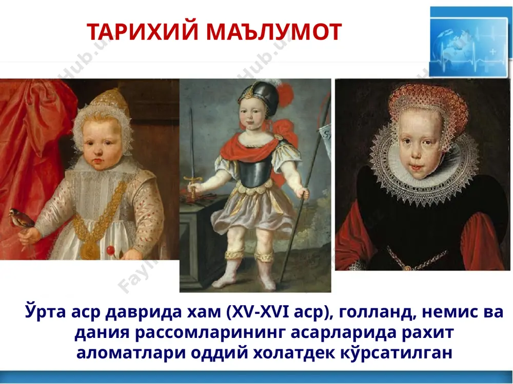 ш кузатилмайди гуллаш давр клиникаси марказий ва вегетатив нерв системаси: терлашнинг кучайиши умумий холсизликнинг ортиши психомотор ривожланишдан ортда қолиши эмоционал лабиллик гуллаш давр клиникаси мушак гипотонияси (қабзиятнинг кучайиши) “қурбақасимон қорин” “қайирма пичоқ” симптоми мушак системаси: гуллаш давр клиникаси остеомаляция белгилари: катта лиқилдоқ четларининг юмшаши гуллаш давр клиникаси энса суягининг яссилиги “эгарсимон” бурун остеомаляция белгилари: гуллаш давр клиникаси остеомаляция белгилари: гаррисон эгати кифоз, сколиоз, рахитик букрлик гуллаш давр клиникаси х ва о симон оёқлар “этикдўз кўкраги” остеомаляция белгилари: гуллаш давр клиникаси пешона ва чакка дўнглигининг ўсиши –«caput quadratum» «олимпик пешона» катта лиқилдоқнинг эрта ёпилиши суяк тўқимаси гиперплазияси белгилари: рахитнинг гуллаш давр клиникаси қовурғадаги рахитик «чёткалар» кафтдаги “билакузуклар” бармоқдаги “марварид иплари” суяк тўқимаси гиперплазияси белгилари: рахитнинг гуллаш давр клиникаси суяк тўқимаси гипоплазияси белгилари: лиқилдоқларнинг кеч битиши; тишларнинг кеч чиқиши тишлам (прикус) бузилиши суяк узунлиги ўсиши ортда қолиши суяклар деформацияси бошдаги катта лиқилдоқнинг кеч беркилиши бош: тишларнинг ёриб чиқишининг кечикиши (ўз вақтида эмас, …