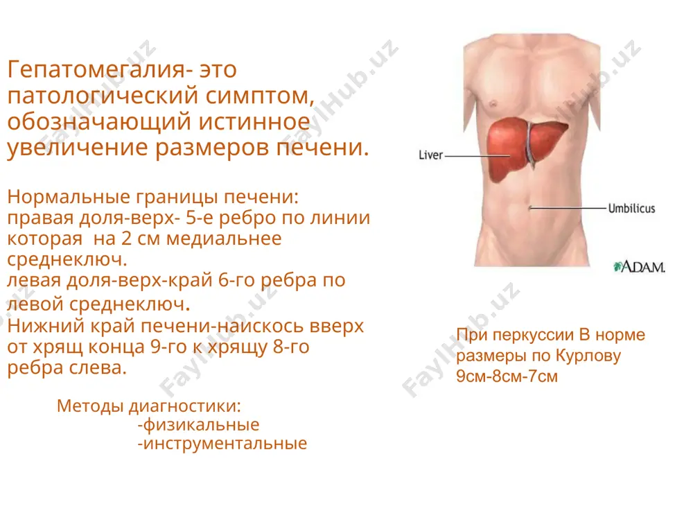 воротной вены. тромбообразование в воротной вене может быть обусловлено несколькими причинами: повышением свертываемости крови и/или изменением соотношения ее клеточных элементов (постоперационный период, гематологическая и онкологическая патологии), снижением скорости кровотока в воротной вене (сдавление сосуда извне опухолью, рубцами, хроническая сердечная недостаточность), интраоперационной травмой сосуда. * синдром бадда-киари это обструкция печеночных вен, которая наблюдается на уровне их впадения в нижнюю полую вену и приводит к нарушению оттока крови из печени. -стеноз -тромбоз развивается на фоне миелопролиферативного заболеваний, приема оральных контрацептивов, эритремии, облучение печени и т.д. -мембранозного заращения нижней полой вены. обструкцию крупных вен печени могут вызвать механическое сдавление, в том числе воспалительным инфильтратом (например, при амебном абсцессе печени), прорастание злокачественной опухолью, инвазия эхинококка. однако наиболее частой причиной нарушения оттока крови по печеночным венам является тромбоз. * а - синдром бадда-киари +вторичная обструкция нижней полой вены. абдоминальные вены расширяются; формируются коллатерали. в венография: правая печеночная вена не визуализируется; сеть коллатералей выглядит, как паутина. …