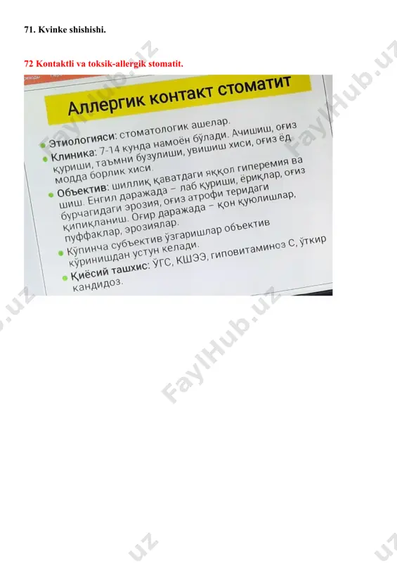 rsildoqni klinikasi. 74. nikolskiy simptomi 1. 75 nikolskiyning simptomi 2. 76. nikolskiyning alomati 3. 77. asbo-xans simptomi. 78 olma jele simptomi. 79 toshli yol simptomi. 80 papiros qog'ozi simptomi. 81. kokaradaning simptomi. 82. pemfigoid. klinika. 83. pemfigoid. differentsial diagnostika. davolash. 84. simop stomatit. klinikasi. 85 qo'rg'oshin stomatit. 86 vismut stomatit. 87. leykoz klinikasida leykemiya. 88. trombotsitopenik purpura.og'iz shilliq qavatining o'zgarishi. 89. gastritdagi obshk ning o'zgarishi. 90. oshqozon yarasida og'iz bochligida o'zgarishi. 91. kollits holatida obshk da o'zgartirishlar. 92. gipertonik kasallikdagi obshk ning o'zgarishi. 93 makroheylit klinikasi. differentsial diagnostika. 94. qandli diabet. obshk-da o'zgartirishlar. 95 gipo va vitamin etishmasligi. obshk-da o'zgarishlar. 96. qizil ygurug .klinikasi.etiologiya. 97. fakultativ rak oldi kasalliklari. 98 obligat rak oldi kasalliklari. 99. bowen kasalligi. klinika. 100. manganotti abraziv prekanseroz heiliti. image7.png image8.png image9.png image10.png image11.png image12.png image13.png image14.png image15.png image16.png image17.png image18.png image19.png image20.png image21.png image22.png image23.png image24.png image1.png image2.png image3.png image4.png image5.png image6.png