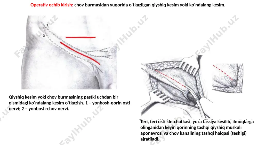 tilgan usullar a-jirar usuli b-martinov usuli c-spasokukotskiy usuli d-kimbarovskiy-spasokukotskiy orqa devorini mustahkamlash usullari e-bassini f-krimov image1.png image2.png image3.png image4.png image5.png image6.png image7.png image8.png image9.png image10.png image11.png image12.png image13.png image14.png image15.png image16.png image17.png image18.png image19.png image20.png image21.png image22.png image23.png image24.png /docprops/thumbnail.jpeg
