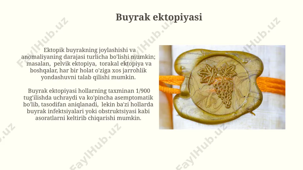 iyasini saqlab qolishga qaratilgan bo'lib, bunday holatlarda 30% hollarda jarrohlik aralashuvi zarur bo'ladi. buyrak displaziyasi, tug'ma anomaliya bo'lib, buyrak to'qimalarining noto'g'ri rivojlanishi bilan tavsiflanadi va taxminan 1000 tug'ilishdan 1 tasida uchraydi, bu esa jiddiy nefropatiya xavfini oshiradi. atrof-muhit omillari buyrak displaziyasi kabi ba'zi tug'ma nuqsonlarning rivojlanishida genetik omillar bilan birga, 15% dan ortiq holatlarda atrof-muhit omillari muhim rol o'ynaydi, bu esa davolash strategiyasini murakkablashtiradi. buyrak atreziyasi holatlarida, taxminan 10% hollarda ikkala buyrakka ham ta'sir qiladi va bu holat tug'ma buyrak yetishmovchiligini keltirib chiqarishi mumkin. davolashning murakkabligi poliqistik buyrak kasalligi kabi ba'zi irsiy kasalliklarning davolashida, bemorning yoshi va kasallikning og'irligiga qarab, 5-10 yildan keyin buyrak transplantatsiyasi zarur bo'lishi mumkin. buyrak nuqsonlarini davolashda, ayniqsa, murakkab tug'ma anomaliyalarda, 30% dan ortiq hollarda jarrohlik aralashuvi talab etiladi, bu esa yuqori xavf va uzoq muddatli reabilitatsiyani anglatadi. kasallikning oldini olish homiladorlik davrida etarli darajada folat kislotasi qabul qilish (kuniga 400 mkg) neyral naychalarning yopilishida muammolar …