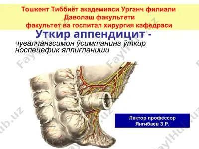 ўткир аппендицит - чувалчангсимон ўсимтанинг ўткир носпецефик яллиғланиши — PPT