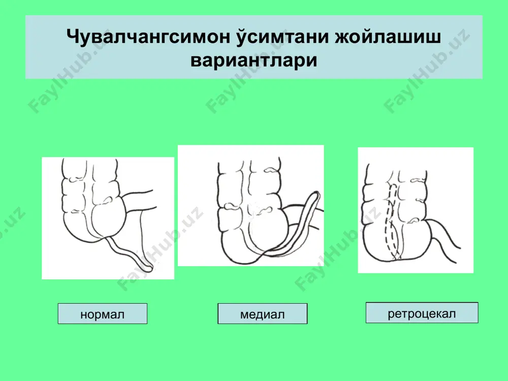 ўткир аппендицит - Page 3