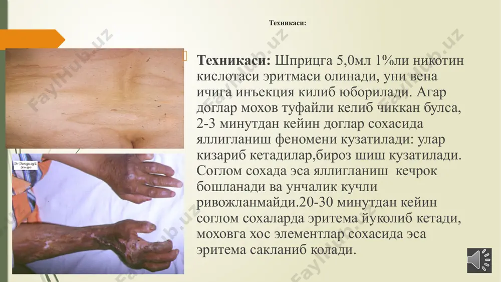 nikotin sinamasini kuyish - Page 3