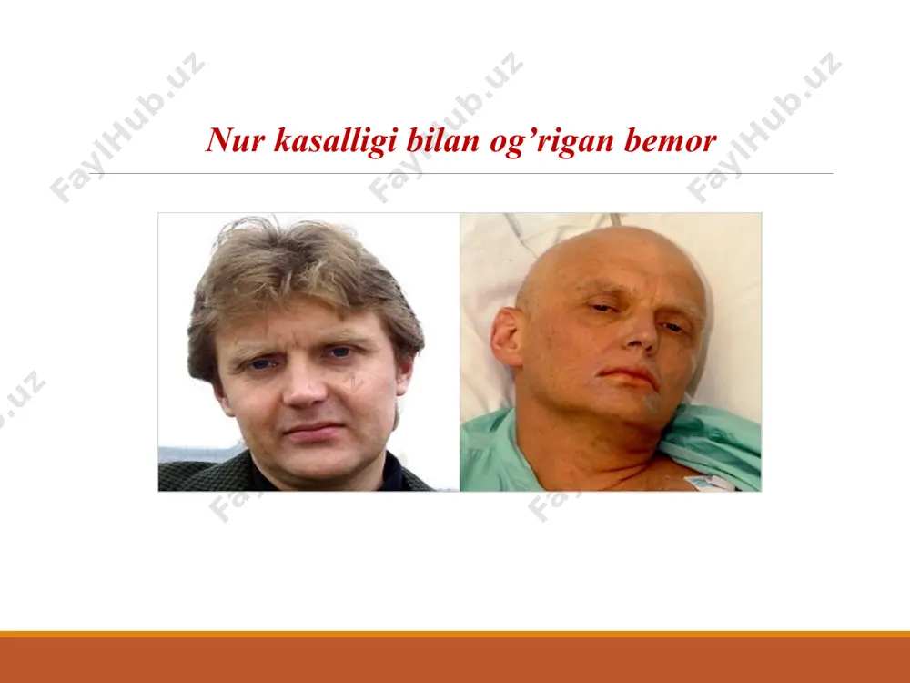 odam va xayvonlarning o’tkir va surunkali nurlanish kasalligi - Page 4