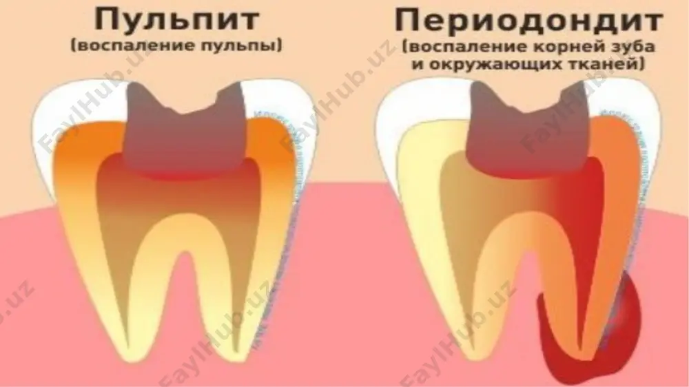 periodontitlarnidavolashusullari - Page 5