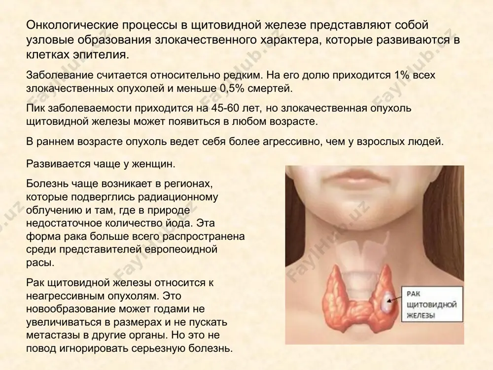 ующим облучением у медицинского персонала, у рабочих в горячих цехах или деятельность, связанная с тяжелыми металлами. стрессовые ситуации. сильные стрессы, после которых человек долго не может прийти в себя и депрессии подрывают иммунитет. а ведь именно иммунные клетки отвечают за уничтожение раковой опухоли. вредные привычки. табачный дым содержит канцерогенные вещества, а алкоголь ослабляет естественную защиту организма против нетипичных клеток. также могут способствовать хронические болезни: заболевания женских половых органов. хронические болезни матки и яичников, особенно если они сопровождаются гормональным нарушением. опухоли молочных желез. доброкачественные и злокачественные новообразования в груди у женщин (особенно гормонозависимые). полипы прямой кишки и рак толстого кишечника. многоузловой зоб. доброкачественные опухоли и узелки щитовидной железы. виды рака щж папиллярный рак щитовидной железы такие раковые опухоли имеют на своей поверхности множество выступов, напоминающих сосочки. из-за этого новообразование становится похоже на лист папоротника. папиллярный рак относится к высокодифференцированным опухолям. это значит, что его клетки на первый взгляд похожи на нормальные …