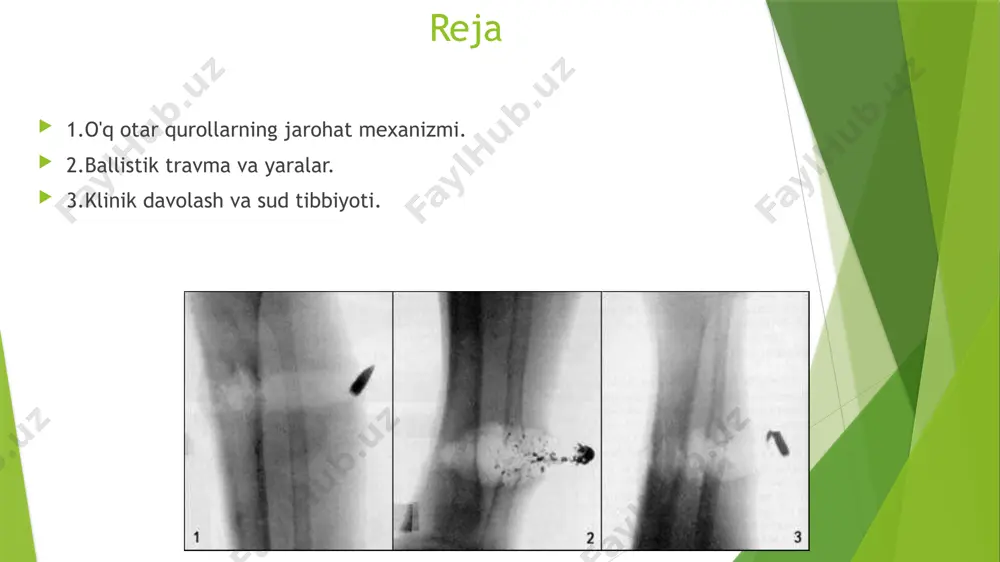 r turda davolash usullari va prognozlar farq qiladi. 3 tahlil usullari yaralarning tahlili jarohatlarning xilma-xilligini va ularning o'ziga xos belgilarini aniqlashga yordam beradi. bu jarayon sud tibbiyotida muhim bo'lib, forensik ekspertizalar uchun zarurdir. ballistik travma: o'qning inson tanasiga ta'siri va zararlanish mexanizmi. 1 o'qning mexanikasi o'qning inson tanasiga ta'siri, uning tezligi, massasi va balistik yo'nalishi bilan belgilanadi, bu jarohat mexanizmini aniqlashda muhim ahamiyatga ega. 2 ballistik zarba o'q tanaga kirganda, u energiya o'tkazadi va jarohatlaydi. bu jarohatlar ko'plab omillarga, jumladan, o'qning turi va tezligiga bog'liq. 3 yaralar tahlili o'q otar jarohatlarining tahlili, ularning shakli va chuqurligi, davolash jarayonini belgilashda muhim bo'lib, forensik tahlil uchun keraklidir. yaralar tahlili: o'q otar jarohatlarining xususiyatlari va ularning davolash usullari. o'q otar jarohatlari tahlilida yaralar xususiyatlari va davolash usullari muhim ahamiyatga ega. bular quyidagilarni o'z ichiga oladi: - yaralarning turli xil shakllari va chuqurligi. - o'qning kirish va chiqish nuqtalari. - davolashda jarrohlik, antibiotiklar va …