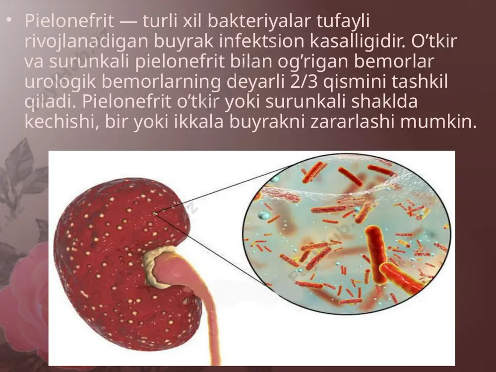 maydi. siydik loyqa bo’ladi yoki qizg’ish tus oladi. laborator siydik tahlilida bakteriuriya, biroz proteinuriya va mikrogematuriya aniqlanadi. umumiy qon tahlili leykositoz va echt oshganini ko’rsatadi. taxminan 30% hollarda qonning biokimyoviy tahlili natijasida azotli shlaklarning ortganligi aniqlanadi. surunkali pielonefrit ko’pincha davolanmagan o’tkir shakldagi kasallikning oqibatidir. shuningdek bemor anamnezida o’tkir pielonefrit bo’lmay turib, birdan birlamchi surunkali pielonefrit rivojlanishi mumkin. ba’zan surunkali pielonefrit siydik tahlillari natijasida tasodifan aniqlanadi. surunkali pielonefrit bilan og’rigan bemorlar ko’pincha zaiflik, ishtahaning pasayishi, bosh og’rig’i va tez-tez siydik chiqarishdan shikoyat qiladi. ba’zi bemorlarni sovuq, nam havoda kuchayadigan bel atrofidagi to’mtoq og’riq bezovta qiladi. ikki tomonlama surunkali pielonefritning rivojlanib borishi bilan buyrak faoliyati buziladi, bu esa siydik solishtirma og’irligining ortishiga, gipertoniya va buyrak yetishmovchiligiga olib keladi. surunkali pielonefritning o’tkirlashganini ko’rsatuvchi belgilari o’tkir shakldagi kasallik klinik tasvirlari bilan mos. ikki tomonlama o’tkir pielonefrit o’tkir buyrak yetishmovchiligiga olib kelishi mumkin. eng og’ir asoratlarga sepsis va bakterial shokni misol qilsa bo’ladi. ba’zi hollarda …